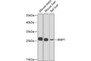 Western blot analysis of extracts of various cell lines, using BNIP1 Antibody (ABIN6127501, ABIN6137615, ABIN6137617 and ABIN6223088) at 1:1000 dilution. (BNIP1 Antikörper  (AA 1-200))