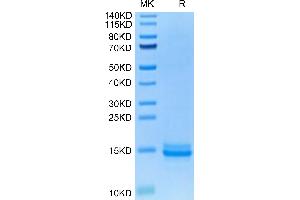 Human LILRB4 Domain 1 on Tris-Bis PAGE under reduced condition. (LILRB4 Protein (AA 22-118) (His-Avi Tag))