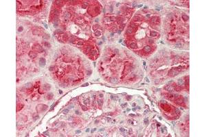 Human Kidney: Formalin-Fixed, Paraffin-Embedded (FFPE) (GGA1 Antikörper  (AA 1-89))