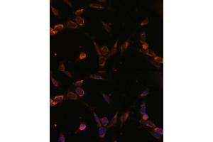 Immunofluorescence analysis of NIH-3T3 cells using USP30 Polyclonal Antibody (ABIN6131133, ABIN6150017, ABIN6150018 and ABIN6216645) at dilution of 1:100 (40x lens). (Usp30 Antikörper  (AA 57-390))