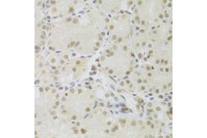 Immunohistochemistry (Paraffin-embedded Sections) (IHC (p)) image for anti-PRP3 Pre-mRNA Processing Factor 3 Homolog (PRPF3) (AA 1-280) antibody (ABIN6146260)