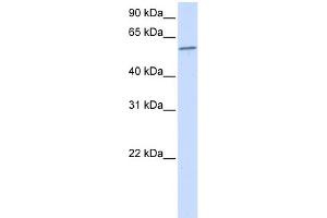 Western Blotting (WB) image for anti-Protein Phosphatase 3, Catalytic Subunit, alpha Isoform (PPP3CA) (N-Term) antibody (ABIN2784523)