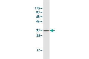 Western Blot detection against Immunogen (30. (CCR2 Antikörper  (AA 1-42))
