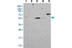 Western blot analysis of Lane 1: RT-4, Lane 2: U-251 MG, Lane 3: Human Plasma, Lane 4: Liver, Lane 5: Tonsil with CORO2A polyclonal antibody . (CORO2A Antikörper)