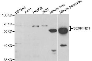 Western blot analysis of extracts of various cell lines, using SERPIND1 antibody (ABIN5973459) at 1/1000 dilution. (SERPIND1 Antikörper)