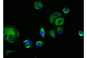 Immunofluorescence staining of MCF-7 cells with ABIN7173899 at 1:166, counter-stained with DAPI. (EDAR Antikörper  (AA 27-170))
