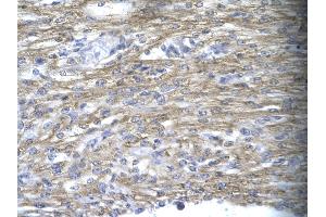 Immunohistochemistry (IHC) image for anti-Mesenchyme Homeobox 1 (MEOX1) (N-Term) antibody (ABIN2777534)