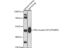 Western blot analysis of extracts of various cell lines, using PGE receptor EP3 (PTGER3) antibody (ABIN1682372, ABIN3018477, ABIN3018478 and ABIN6220477) at 1:3000 dilution. (PTGER3 Antikörper  (AA 1-53))