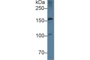 Detection of APOB in Rat Liver lysate using Monoclonal Antibody to Apolipoprotein B (APOB) (APOB Antikörper  (AA 2747-2913))