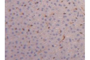 Detection of FABP4 in Mouse Liver Tissue using Polyclonal Antibody to Fatty Acid Binding Protein 4 (FABP4) (FABP4 Antikörper  (AA 2-132))