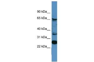 WB Suggested Anti-CANX  Antibody Titration: 0. (Calnexin Antikörper  (C-Term))