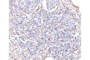 IHC analysis of KCNQ1 using anti-KCNQ1 antibody (ABIN4886647).