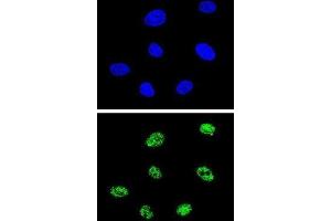 Immunofluorescence (IF) image for anti-Tumor Protein P73 (TP73) antibody (ABIN3003949) (Tumor Protein p73 Antikörper)