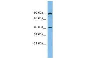 Image no. 1 for anti-Zinc Finger, MYND Domain Containing 12 (ZMYND12) (AA 35-84) antibody (ABIN6744891) (ZMYND12 Antikörper  (AA 35-84))