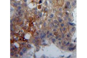 IHC-P analysis of Lung tissue, with DAB staining. (GP5 Antikörper  (AA 17-242))