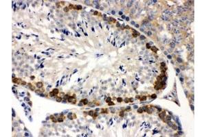 IHC testing of FFPE mouse testis with YB1 antibody. (YBX1 Antikörper)