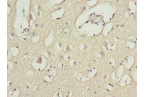 Immunohistochemistry of paraffin-embedded human brain tissue using ABIN7143362 at dilution of 1:100 (MOCS3 Antikörper  (AA 271-460))