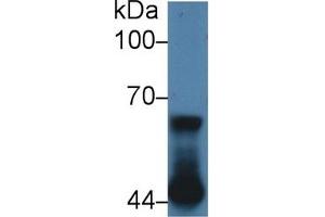 Detection of NUP62 in Human A431 cell lysate using Polyclonal Antibody to Nucleoporin 62 (NUP62) (NUP62 Antikörper  (AA 186-432))