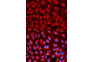 Immunofluorescence analysis of U2OS cell using TFAM antibody. (TFAM Antikörper)