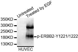 Western blot analysis of extracts of HUVEC cell line, using Phospho-ERBB2-Y1221/1222 antibody (ABIN5995602). (ErbB2/Her2 Antikörper  (pTyr1221, pTyr1222))
