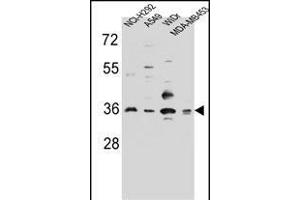 RIC3 Antibody (C-term) (ABIN656649 and ABIN2845890) western blot analysis in NCI-,A549,WiDr,MDA-M cell line lysates (35 μg/lane). (RIC3 Antikörper  (C-Term))