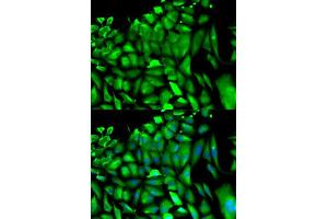 Immunofluorescence analysis of HeLa cells using PGK1 antibody (ABIN5971017).