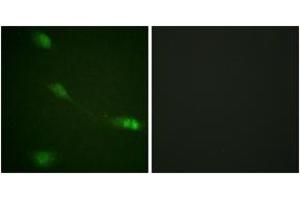 Immunofluorescence analysis of NIH-3T3 cells, using MDM2 (Ab-166) Antibody. (MDM2 Antikörper  (AA 132-181))