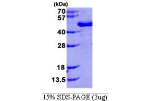 SDS-PAGE (SDS) image for N-Acetyltransferase 6 (GCN5-Related) (NAT6) (AA 1-308) protein (His tag) (ABIN667732) (NAT6 Protein (AA 1-308) (His tag))