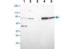 Western Blot analysis of Lane 1: RT-4, Lane 2: U-251MG sp, Lane 3: human plasma (IgG/HSA depleted), Lane 4: human liver and Lane 5: human tonsil lysates with ASMTL polyclonal antibody .