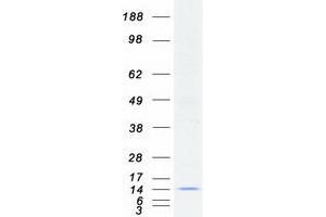 Western Blotting (WB) image for Chromosome X Open Reading Frame 61 (CXORF61) protein (Myc-DYKDDDDK Tag) (ABIN2724273)
