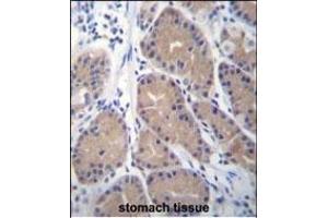 CA1 Antibody (N-term) (ABIN656574 and ABIN2845835) immunohistochemistry analysis in formalin fixed and paraffin embedded human stomach tissue followed by peroxidase conjugation of the secondary antibody and DAB staining.