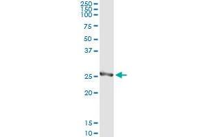 Western Blotting (WB) image for anti-Hydroxyprostaglandin Dehydrogenase 15-(NAD) (HPGD) (AA 1-266) antibody (ABIN516680)