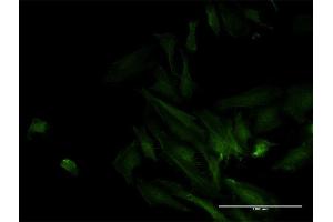 Immunofluorescence of monoclonal antibody to ODF2 on HeLa cell. (ODF2 Antikörper  (AA 706-804))