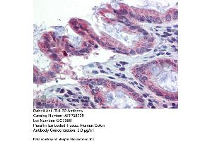 Immunohistochemistry with Human Colon lysate tissue at an antibody concentration of 5. (TULP2 Antikörper  (N-Term))
