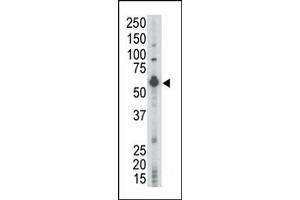 Western Blotting (WB) image for anti-Lymphocyte-Specific Protein tyrosine Kinase (LCK) (N-Term) antibody (ABIN359986) (LCK Antikörper  (N-Term))