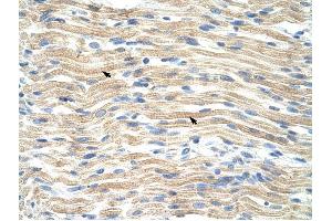 EXOSC6 antibody was used for immunohistochemistry at a concentration of 4-8 ug/ml to stain Skeletal muscle cells (arrows) in Human Muscle. (EXOSC6 Antikörper  (N-Term))