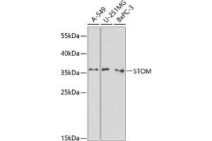 Western blot analysis of extracts of various cell lines, using STOM antibody (ABIN6132876, ABIN6148625, ABIN6148627 and ABIN6218170) at 1:1000 dilution. (Stomatin Antikörper  (AA 55-288))