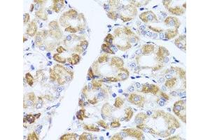 Immunohistochemistry of paraffin-embedded Human stomach using PIK3CA Polyclonal Antibody at dilution of 1:100 (40x lens). (PIK3CA Antikörper)