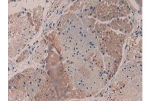 Detection of MYH16 in Human Esophagus Tissue using Polyclonal Antibody to Myosin Heavy Chain 16 (MYH16) (MYH16 Antikörper  (AA 209-469))