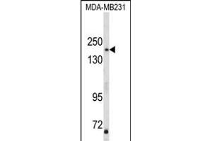 Western blot analysis of TBC1D4 Antibody (N-term) (ABIN652462 and ABIN2842314) in MDA-M cell line lysates (35 μg/lane). (TBC1D4 Antikörper  (N-Term))
