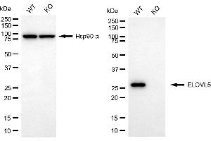 Western blotting analysis using ELOVL5 antibody (ABIN7798435).