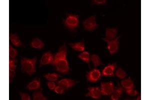 ABIN6267007 staining COLO205 by IF/ICC. (PSMD2 Antikörper  (Internal Region))