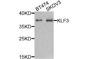 Western blot analysis of extracts of various cell lines, using KLF3 antibody (ABIN5974328) at 1/1000 dilution.