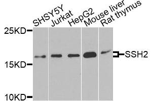 Western blot analysis of extracts of various cells, using SSH2 antibody. (SSH2 Antikörper)