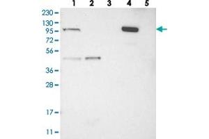 Western blot analysis of Lane 1: RT-4, Lane 2: U-251 MG, Lane 3: Human Plasma, Lane 4: Liver, Lane 5: Tonsil with C1orf112 polyclonal antibody . (C1orf112 Antikörper)