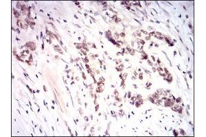 Immunohistochemistry (IHC) image for anti-Nuclear Factor (erythroid-Derived 2)-Like 2 (NFE2L2) (AA 356-589) antibody (ABIN1724931)