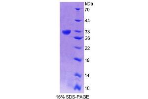 SDS-PAGE analysis of Human GRIK2 Protein. (GRIK2 Protein)