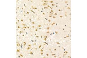 Immunohistochemistry of paraffin embedded rat brain using PGBD5 (ABIN7075082) at dilution of 1:2000 (400x lens) (PGBD5 Antikörper)