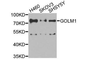 Western blot analysis of extracts of various cell lines, using GOLM1 antibody. (GOLM1 Antikörper  (AA 112-401))