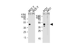 Western blot analysis of lysate from MCF-7, A431 cell line, using CALCR Antibody (C-term) (ABIN651875 and ABIN2840433) with(+) or without(-) peptides. (Calcitonin Receptor Antikörper  (AA 465-494))